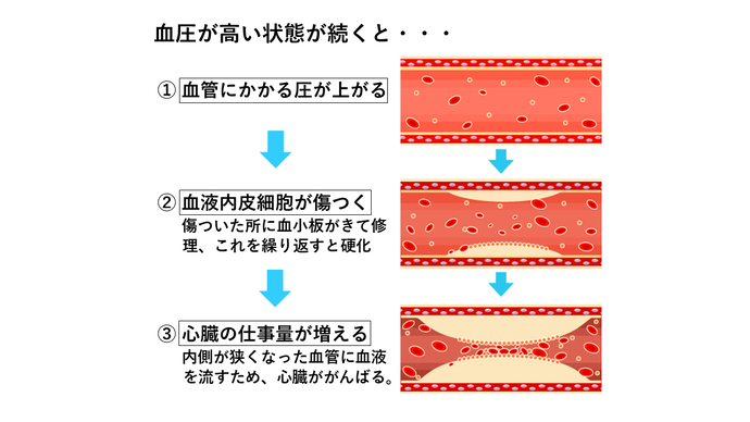 血圧イメージ